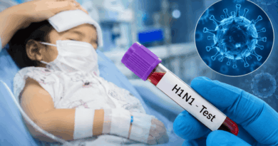 दुर्ग में Swine Flu की एंट्री, 2 साल की बच्ची में H1N1 की पुष्टि; Health Department अलर्ट